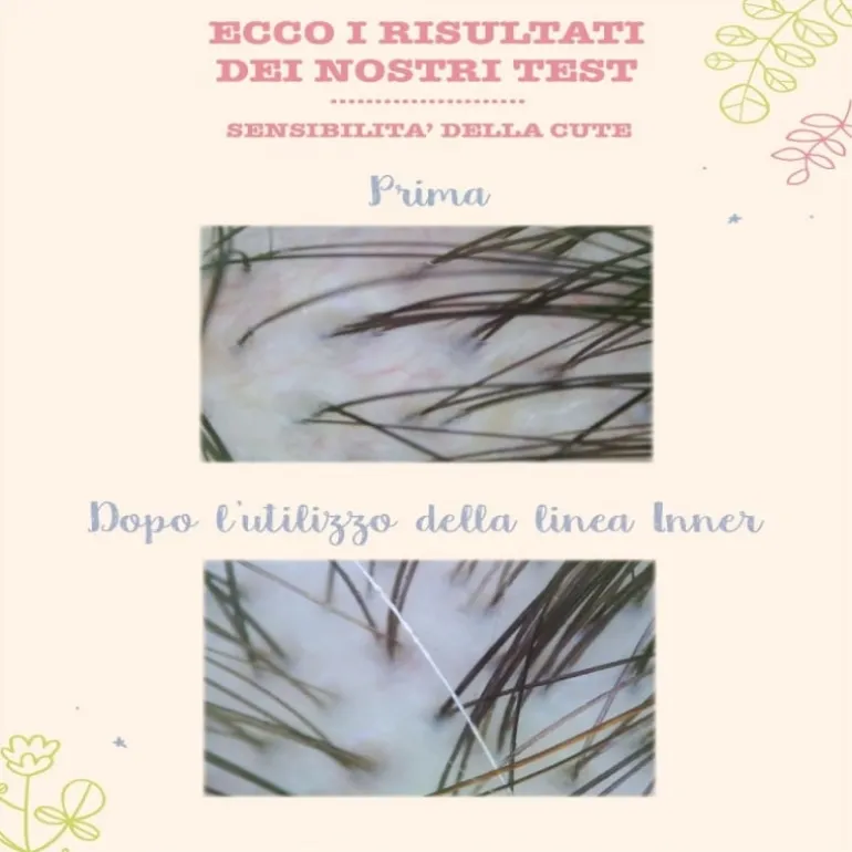 Lozione capelli lenitiva e idratante