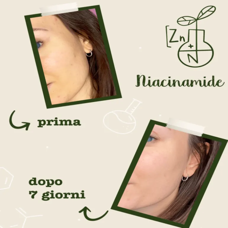 Niacinamide + Zinco